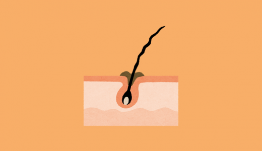 わき毛に『白い粉のようなもの』、毛穴に『白いぶつぶつ』がある、ワキが『黒ずむ』場合はワキガなの？