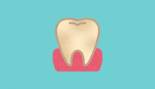 歯の黄ばみは口臭の原因？プラークはエナメル質表面に付着する！